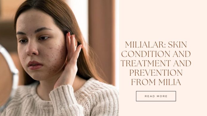 Milialar Skin Condition and Treatment and Prevention from Milia